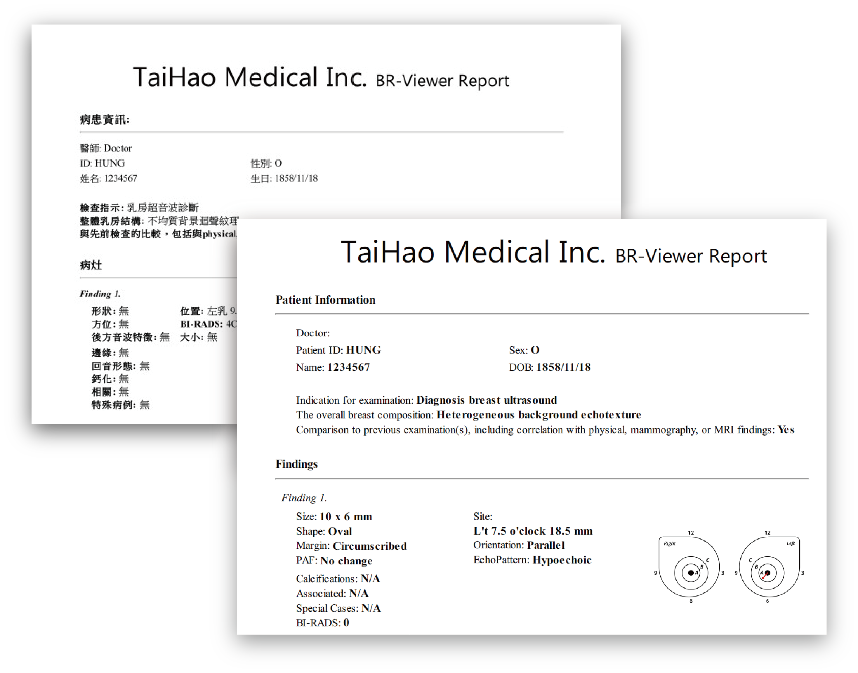 report of BR-Viewer 2